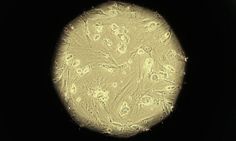 Stem Cell